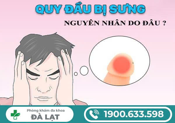 Hình ảnh minh họa